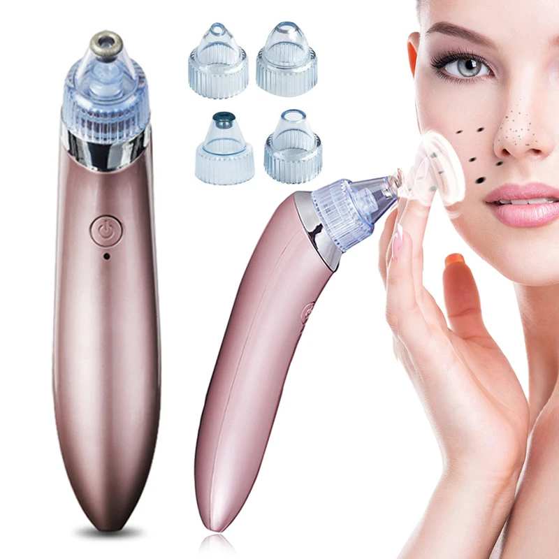 professional blackhead removal