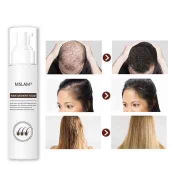 

30ml Natura Plants Hair Growth Dense Regrowth Ginger Serum Oil Anti Loss Treatment Essence Bin Wild Hair Growth Fluid Hair Care