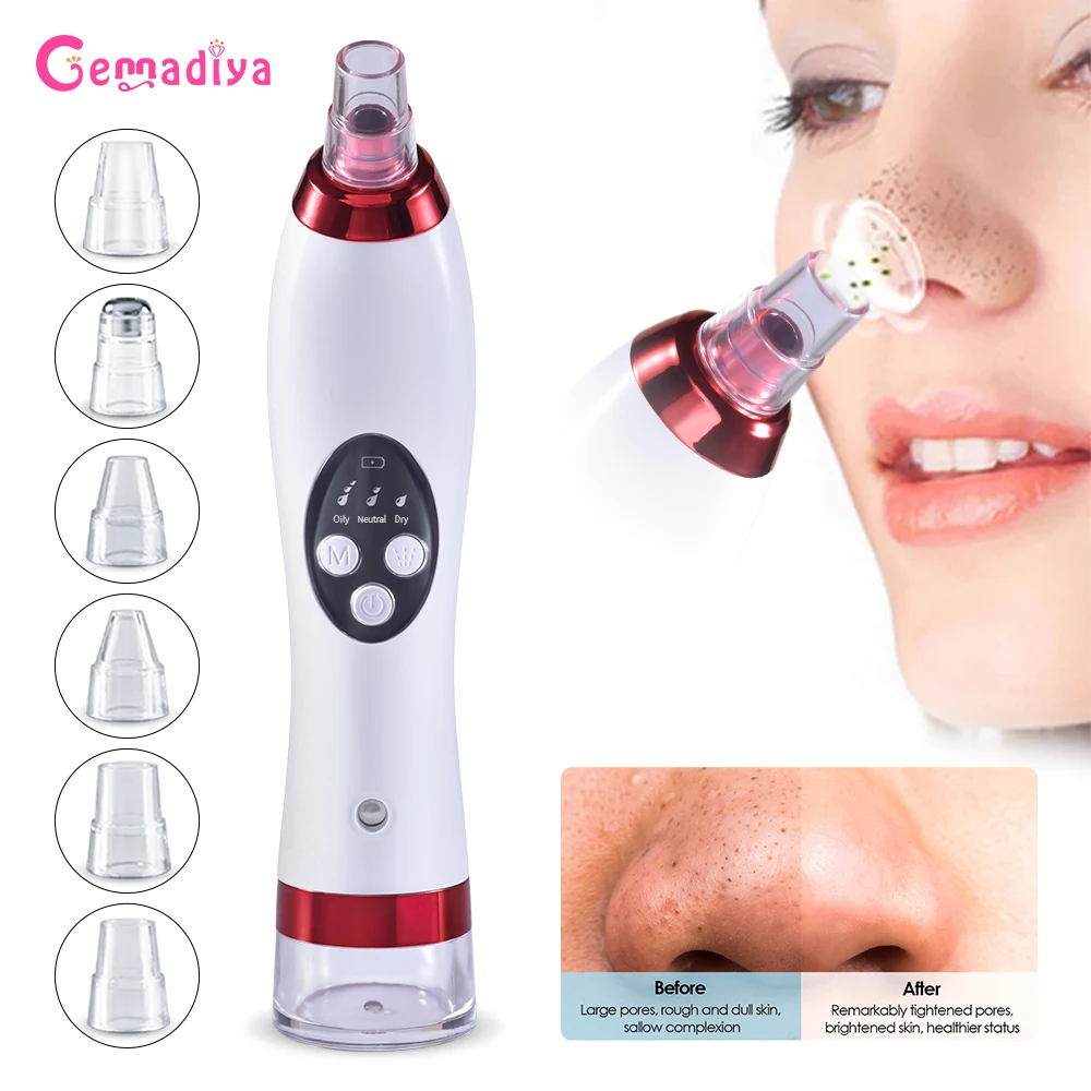 

Facial Blackhead Remover Nose Cleaning T Zone Blackhead Point Vacuum Suction Facial Moisturizer Humidifie Beauty Clean Skin Tool