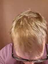Esencia De rápido crecimiento De pelo, productos Para la pérdida del cabello, Fibras Para el crecimiento del cabello, champú, crema De tratamiento Para el cuidado del cabello