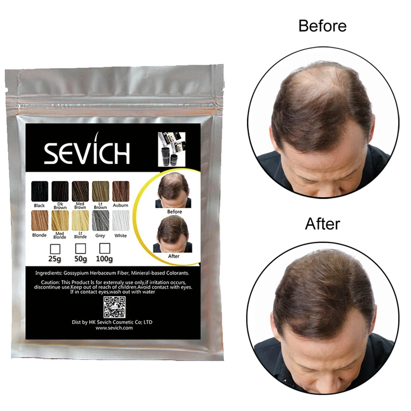 Reducido Sevich-producto corrector para la pérdida de cabello, producto extensor de pelo, polvo de fibra de queratina para el cuidado del cabello, 50g/100g bVnoe6jR5 Reducido Sevich-producto corrector para la pérdida de cabello, producto extensor de pelo, polvo de fibra de queratina para el cuidado del cabello, 50g/100g bVnoe6jR5