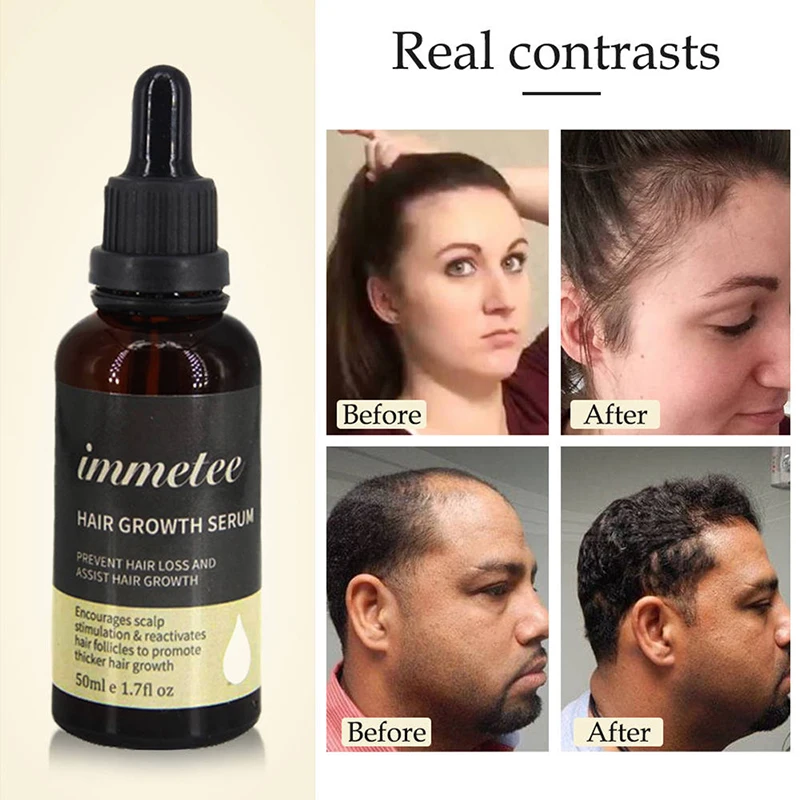 

Natural Hair Growth Tonic Essential Oil Hair Growth Fluid Herbal Essential Liquid