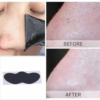 

Hot Sale Charcoal Expert Blackhead Remove New Nose Mask Blackheads Strips Removal Hydrating Pores Cleaning Bamboo 10 PCS