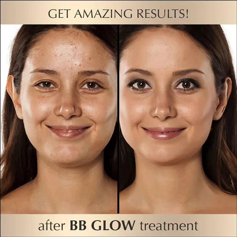 Creme de Brilho Natural Nude Corretivo bb Creme Misturado Conjunto Meso Branco Clareamento Anti-envelhecimento Soro Duradouro 12 Pçs 8ml 27 Beleza e saúde