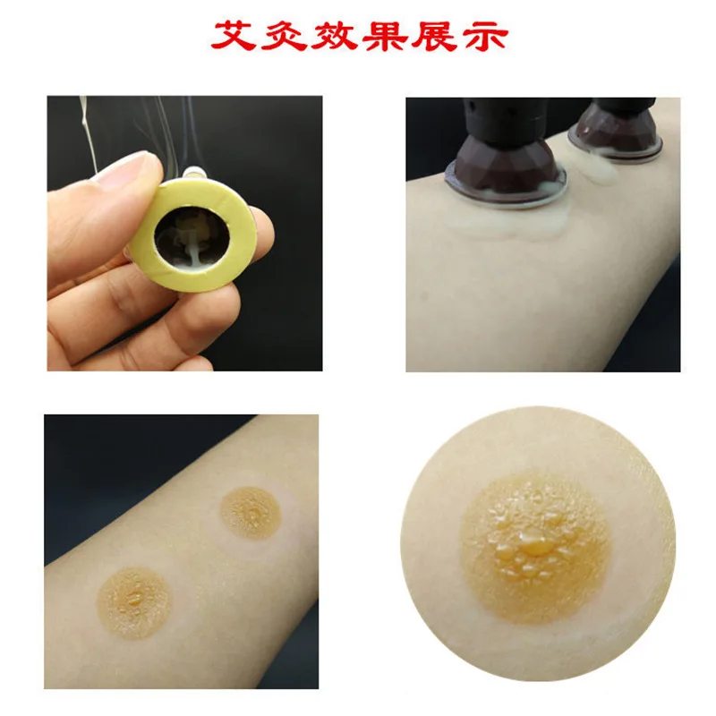 AI Moxibustion 40: 1 Дикий пять лет Чэнь мокса палка Ai разместил павильон прижигания бытовой AI свечи настраиваемые Цзянь Ai Pos