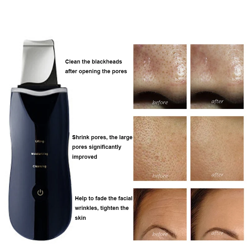 Ultrasonic Ion Deep Cleaning Skin Scrubber Facial Pore Cleaner Peeling Shovel Rechargeable Skin Care Device Beauty Instrument 2