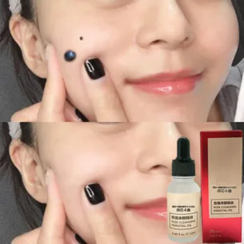 

20ML Painless Mole Skin Dark Spot Removal Mole Skin Tag Removal Solution Face Wart Tag Freckle Removal Cream Oil Plaster