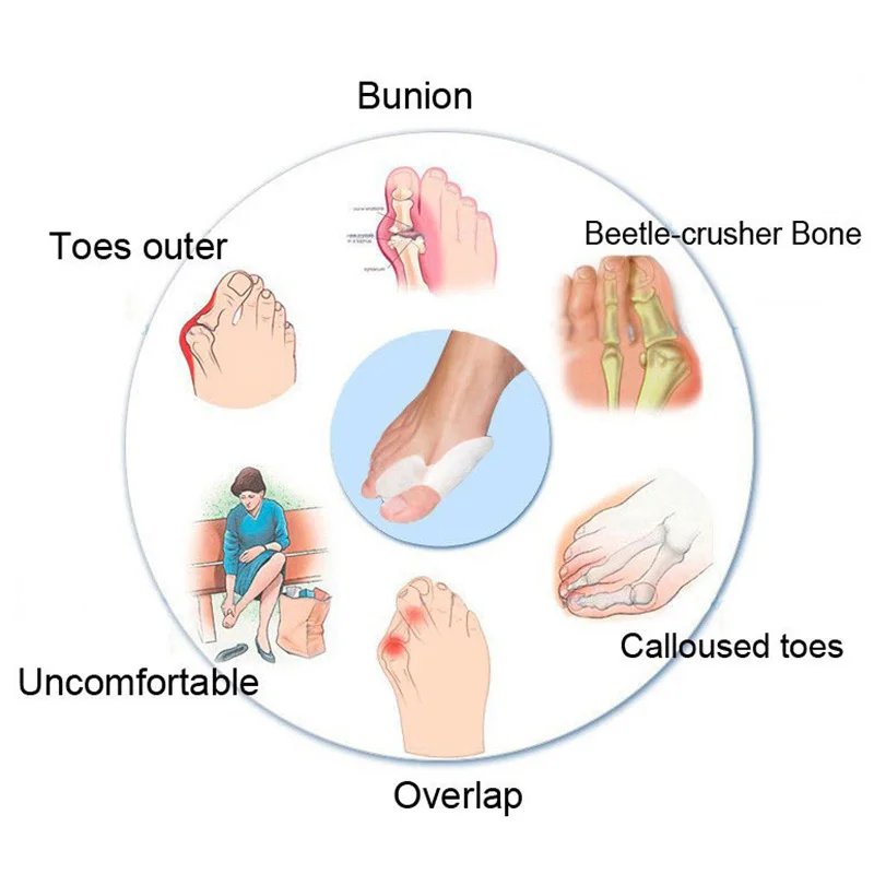 2pcs Silicone Gel Foot Fingers Toe Separator Thumb Valgus Protector Bunion Adjuster Hallux Valgus Pro Guard Feet Care