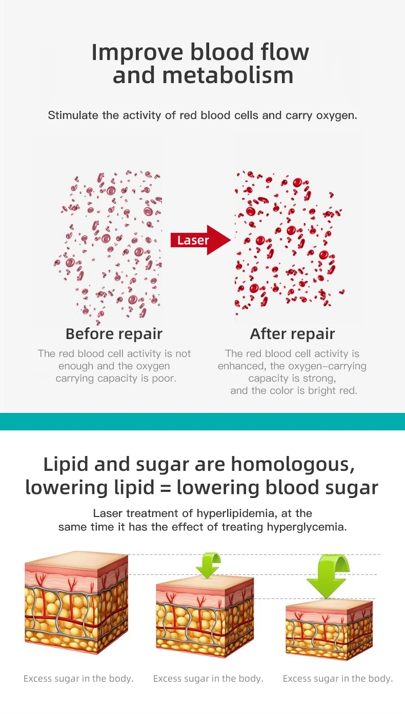 Smartwatches 650nm Laser Treatment Real ECG PPG Blood Pressure Heart Rate Healthy Tracking Work with Xiaomi Android iPhone F800