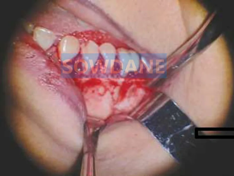 QQ图片20181219124502_副本_副本