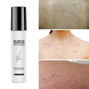 

Tea Tree Serum Spray Acne Treatment Anti-Acne Esscence Anti-wrinkle Care pores Shrink Skin Oil-Control R6J9