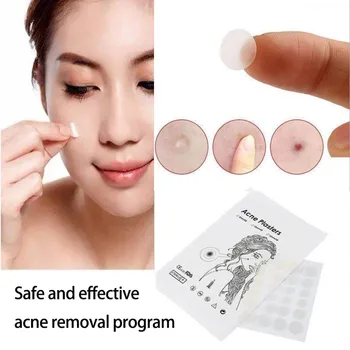 

Invisible Acne Removal Pimple Patch Can Absorb Acne Secretions Effectively Fast Healing Suitable Acts As Protective Cover 36pcs
