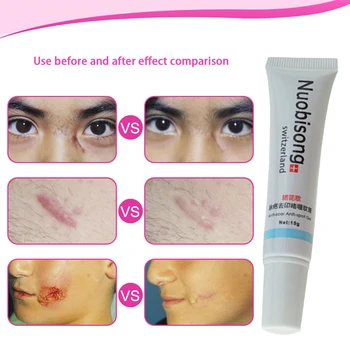 

Sup Nuobisong Remove Scar Cream Remove Spots Remove Striae Gravidarum Pigmentation Corrector -Aging Moisturizing 15ml Massage