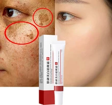 

2pcs 20g Whitening Freckle Cream Remove Melasma Cream Remove Dark Spots Melanin Melasma Remover Brighten Skin Anti-Aging