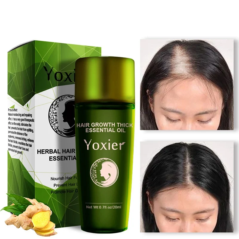 Против выпадения волос масло для роста волос натуральный рост волос утолщаются эфирные масла питательные волосы, кожа головы SC30