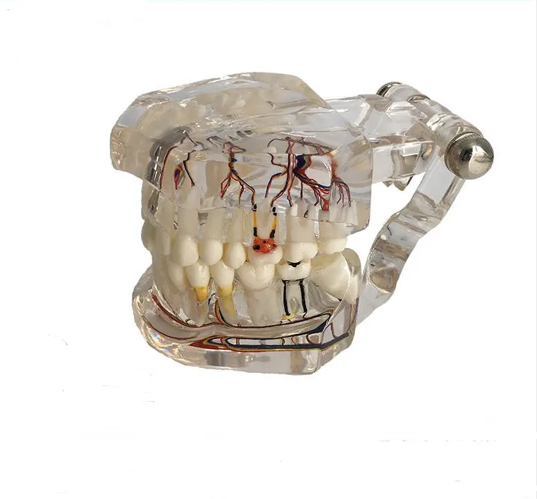 

Teeth Model Dental teeth model implant with nerve Transparent pathological Repair model Tooth Dentist For Teaching