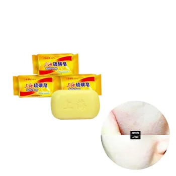 

Sulphur soap herbal preparation of solid soap acne treatment agent for bactericidal anti-inflammatory skin whitening and bathing
