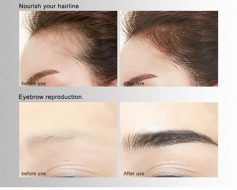eyelash-serum_12