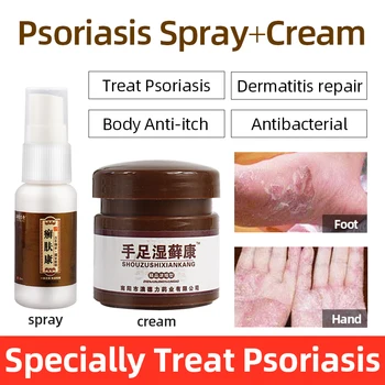 

Hand and Foot Psoriasis Treatment Ointment Works For Erythema Allergy/Eczema Pruritus/Lichen planus/Psoriasis Body Care Cream