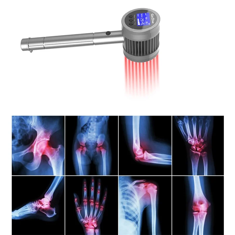 Digital Acupuncture Therapy Instrument Relieve Lumbar Pain Therapeutic Apparatus Portable Semiconductor Cold Laser Therapy