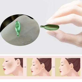 

Vitamin E .vitamin E acne acne removing essence of VE