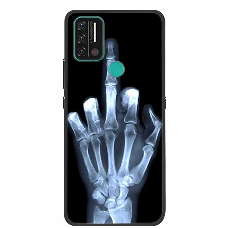 Stylish Soft TPU Silicone Phone Case - Fashionable Back Cover s Capa