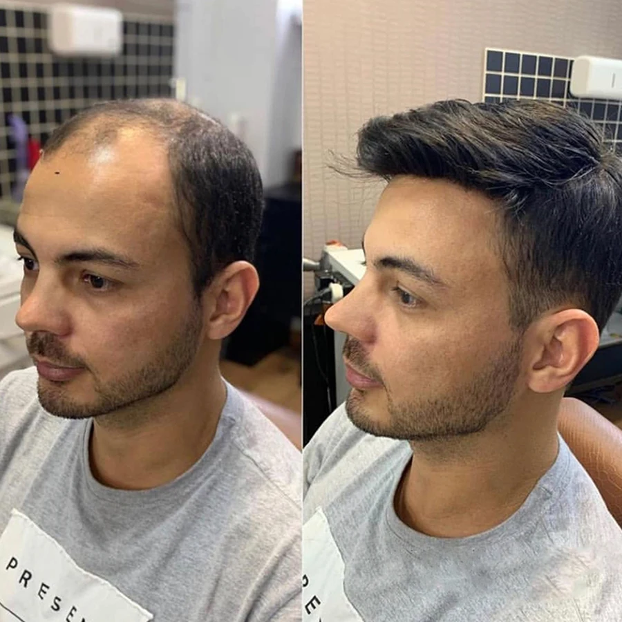 Peluca de cabello humano para hombre, tupé de color negro Natural de 6 pulgadas, sistema de reemplazo de PU, tupé de cabello Remy de encaje, 8x10 pulgadas