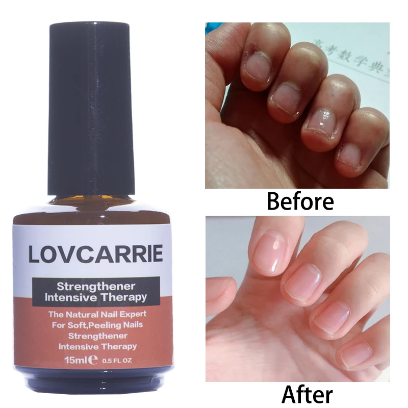 Share 145+ best nail thickener hardener ceg.edu.vn