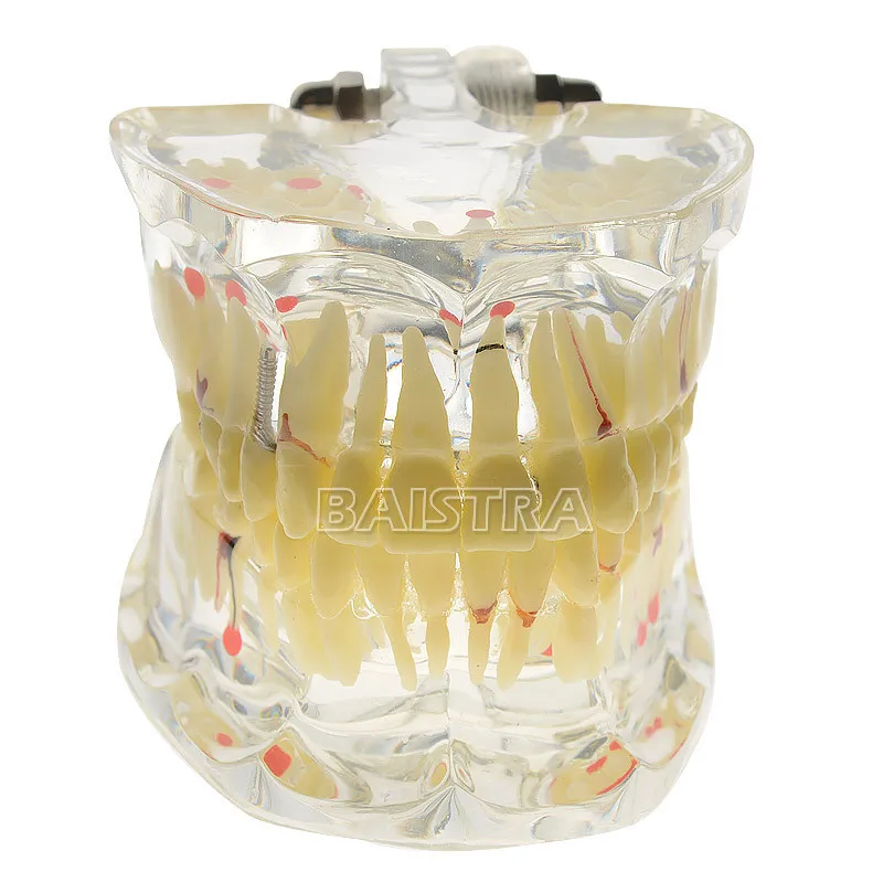 HTB1qPyiXcrrK1Rjy1zeq6xalFXaF