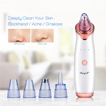 

Blackhead Remover Facial Pore Vacuum Suction USB Rechargeable Cleansing Face Skin Care Dirt Acne Pore Cleaner Facial Tools 45