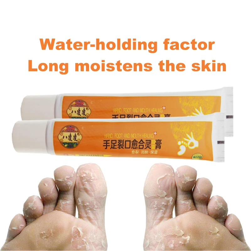 1pcs Powerful Hand Foot Crack Cream Heel Chapped Peeling Foot And Hand Repair Anti Dry Crack Skin Care Chinese Ointment S012