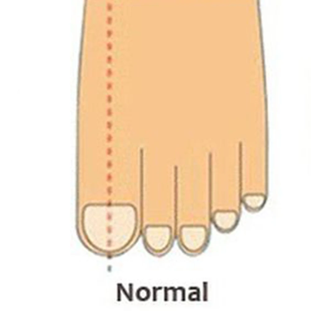1 Pair Silicone Foot Care Gel Bunion Toe Separators Straightener Spreader Correctors Hallux Valgus Correction 2019
