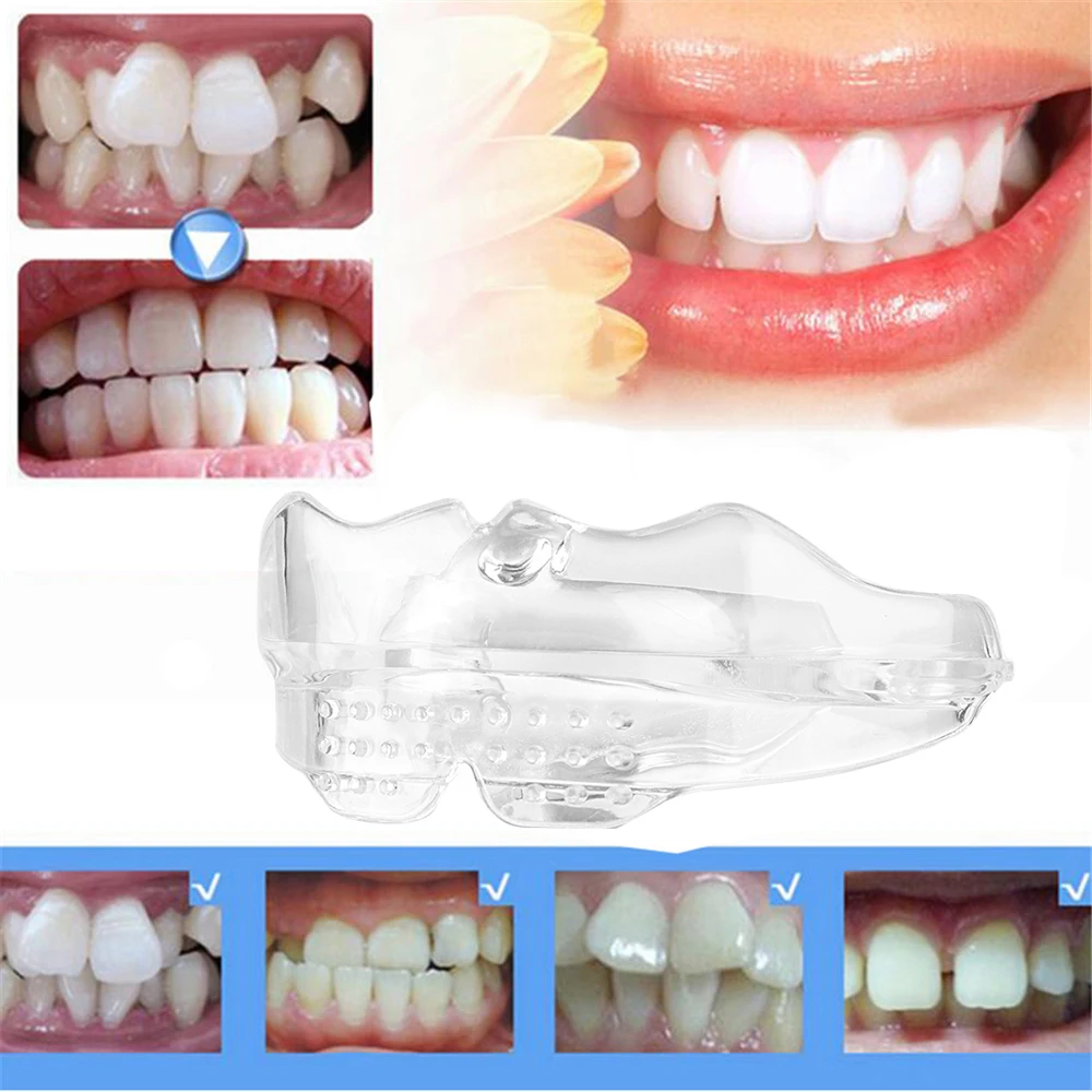 Silicone teeth straightener Clearance