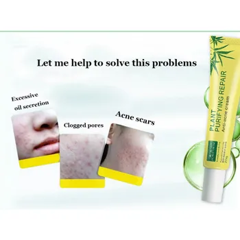 

Repairing Face Cream Cleaning Anti Acne Treatment Scars Cream