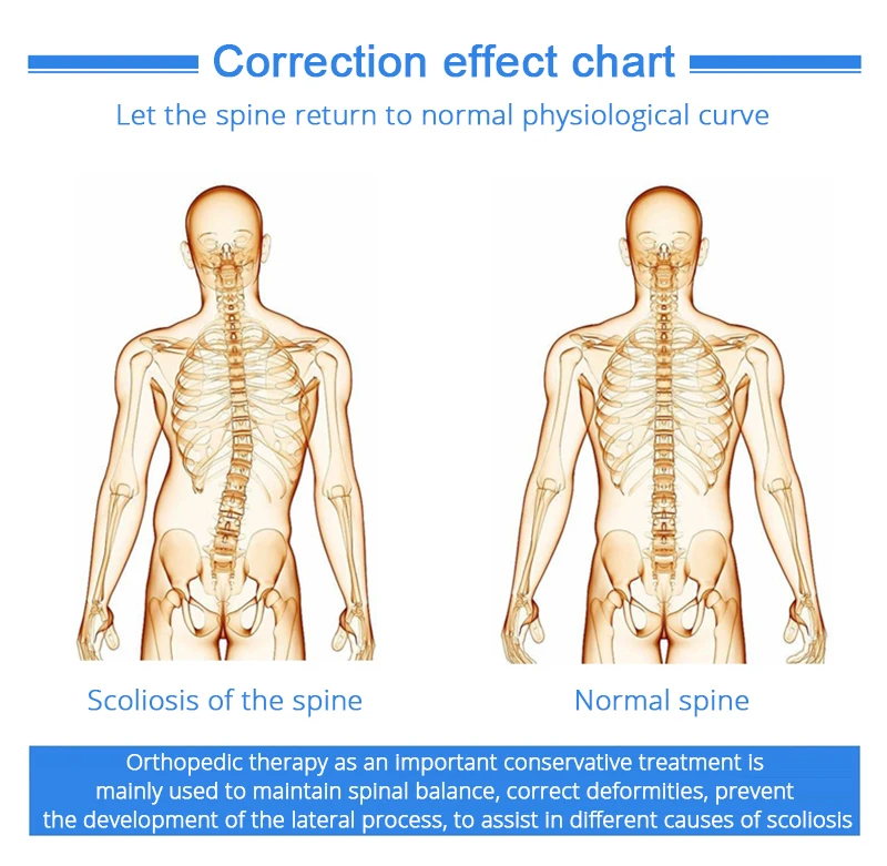 Корректор Осанки Спины Suppor Scoliosis Регулируемый вспомогательный корректор позвоночника для послеоперационного восстановления спины для мужчин и женщин взрослых