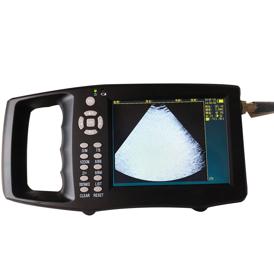 Portable-Pig-Ultrasound-Veterinary-Animal-Pregnancy-Test-Instrument-Color-B-Mode-Ultrasonography-Ultrasonic-Detector (1)