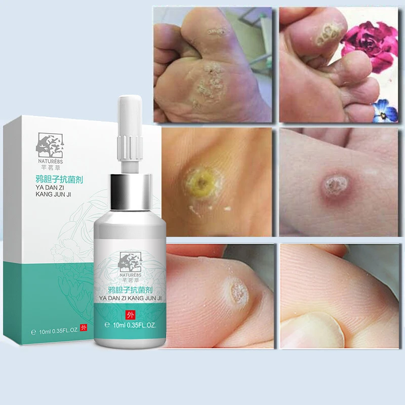 

Antibacterial Agent to Smash Scorpion Scorpion Painless Skin Dark Spot Repair Facial Mark Freckle Repair Cream Oil