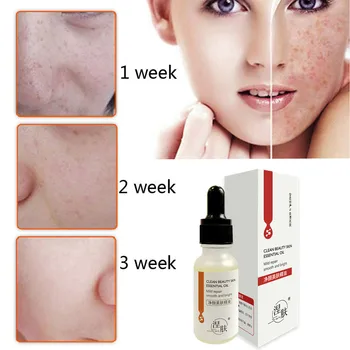 

Ultra Brightening Spotless Oil Beauty Face Serum Dark Spots Removal Age Spots Hyper Pigmentation Moisturizes Skin Face Care