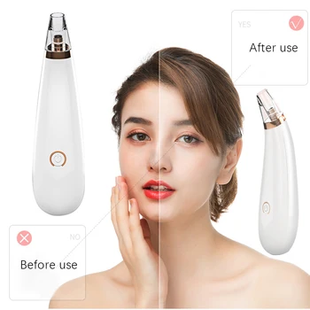 

Electric Acne Remover Point Noir Blackhead Vacuum Extractor Tool Black Spots Pore Cleaner Facial Pore Cleaner Bathroom Products