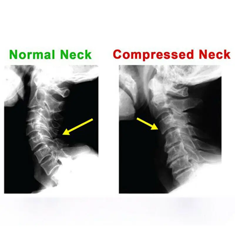 Облегчение боли Подушка шеи и плеча мышцы релаксатор тяговое устройство для шейного отдела позвоночника выравнивание шеи поддержка регулируемая высота