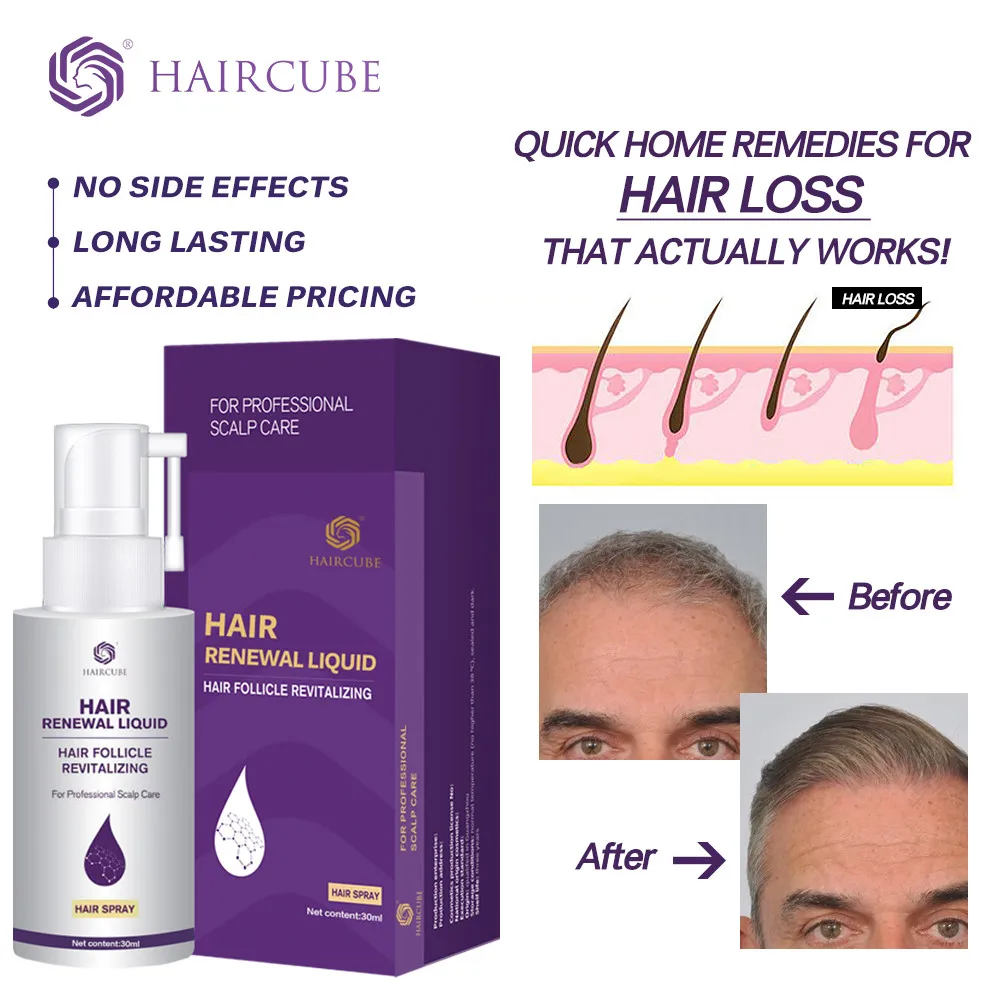 Hair-Growth-Spray Hair Tonic Anti-Hair-Loss-Products for Oil