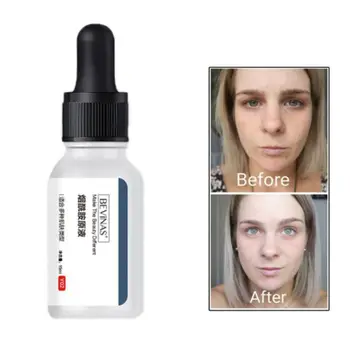 

10% Nicotinamide Face Serum Shrink Pores Oil Balance Reduce Skin Blemishes Whitening Moisturizer 2019