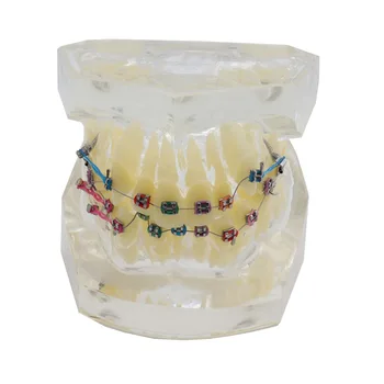 

Dental Standard Orthodontics Teeth Model With Brackets & Buccal Tubes Malocclusion Corret Teeth Model Elastolink Chain Teeth