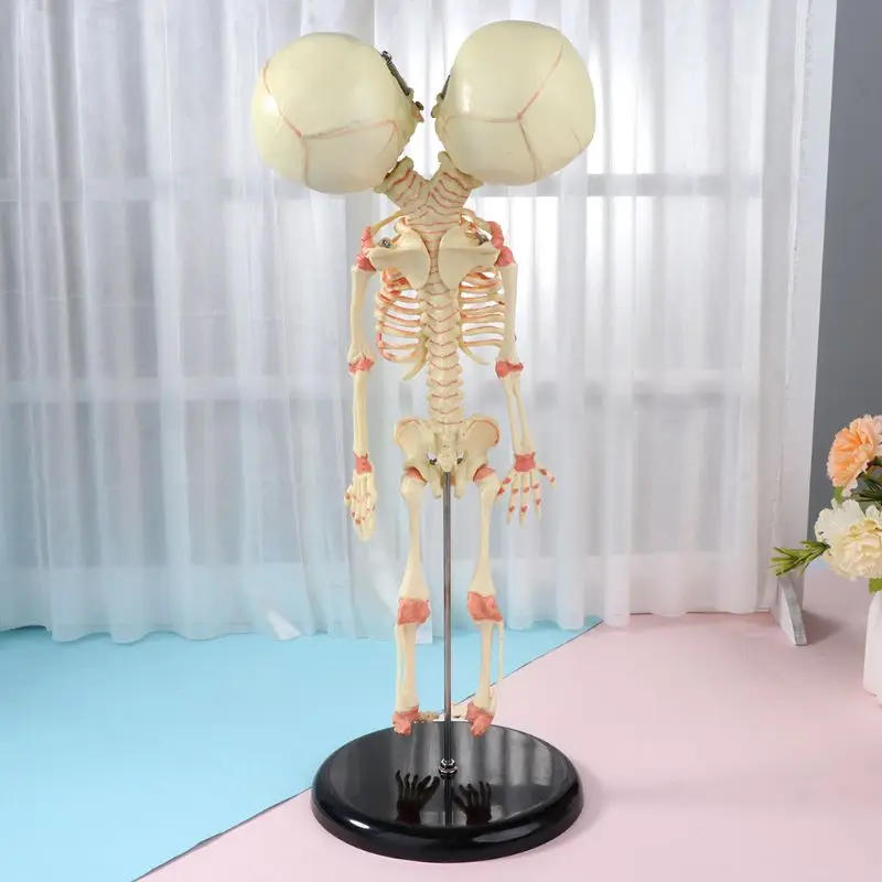  37cm Human Double Head Baby Skull Skeleton Anatomy Brain Display Study Teaching Anatomical Model - 4000040622886