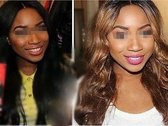 skin brightening cream for dark skin