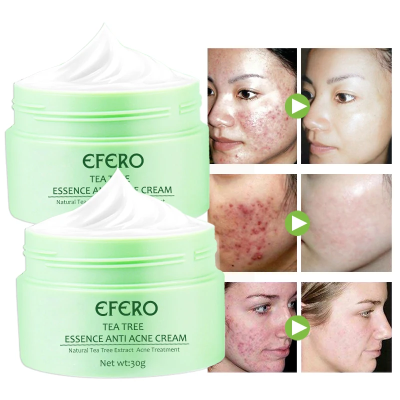 Tea Tree Anti Acne Treatment Face Cream Whitening Moisturizing Cream Shrink Pores Oil Control Anti Aging 3