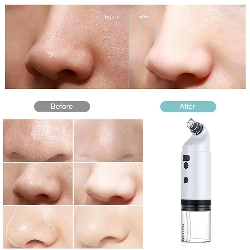 

Small Bubbles Usb Charging Acne Grease Suction Removal Tool Suction Pore Skin Face Care Clean Pimple Blackhead Instr W0Y9