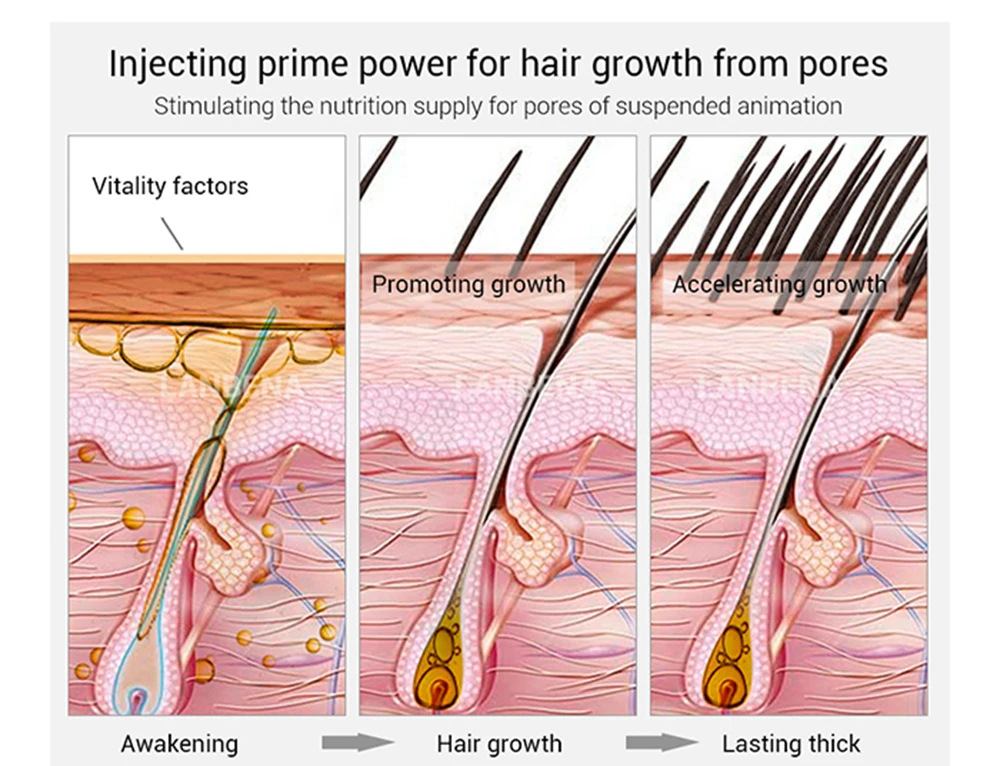 Mokeru 1pc 30ml Ginger Organic Herbal Hair Essential Oil Hair Loss Treatment Fast Growth oil For Women and man
