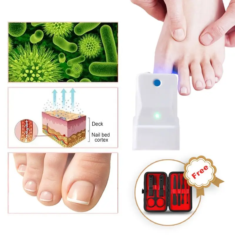 

Highly Effective Rechargeable Nail Fungus Laser Treatment Device Nail Infection Onychomycosis Cure Nail Fungal Infections