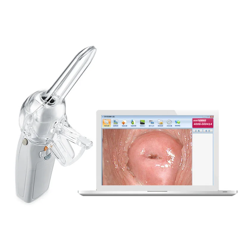 Portable Digital Video Electronic Mini Colposcope FA2 with 3000000 Pixels Camera Endoscope Gynecolo